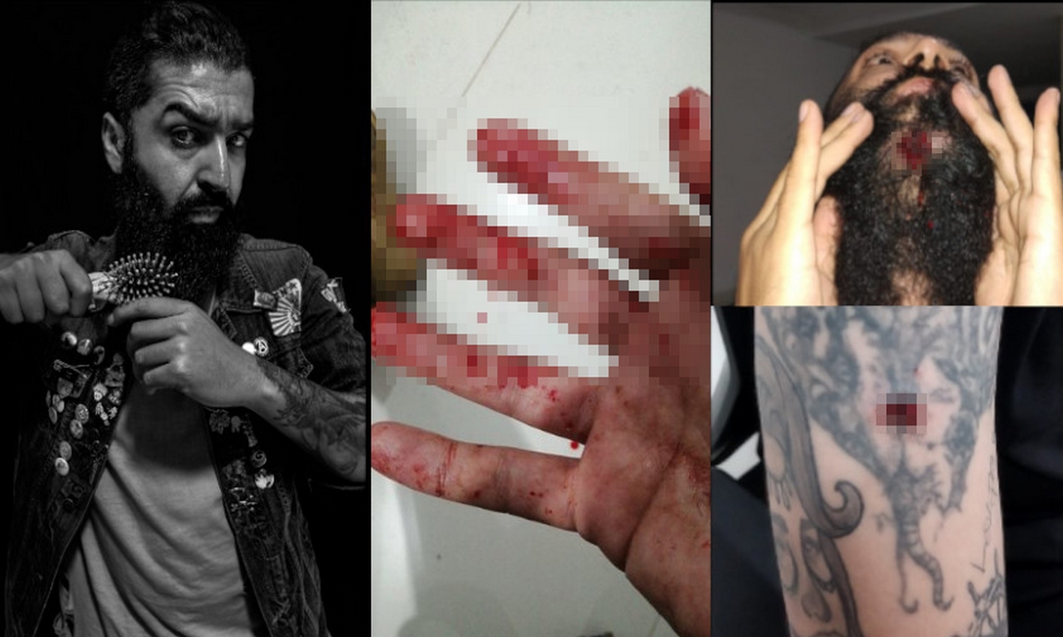 Intentaron matar a fotógrafo tolimense en Cali, le propinaron varios disparos 1 fotógrafo-tolimense-atentado-Cali