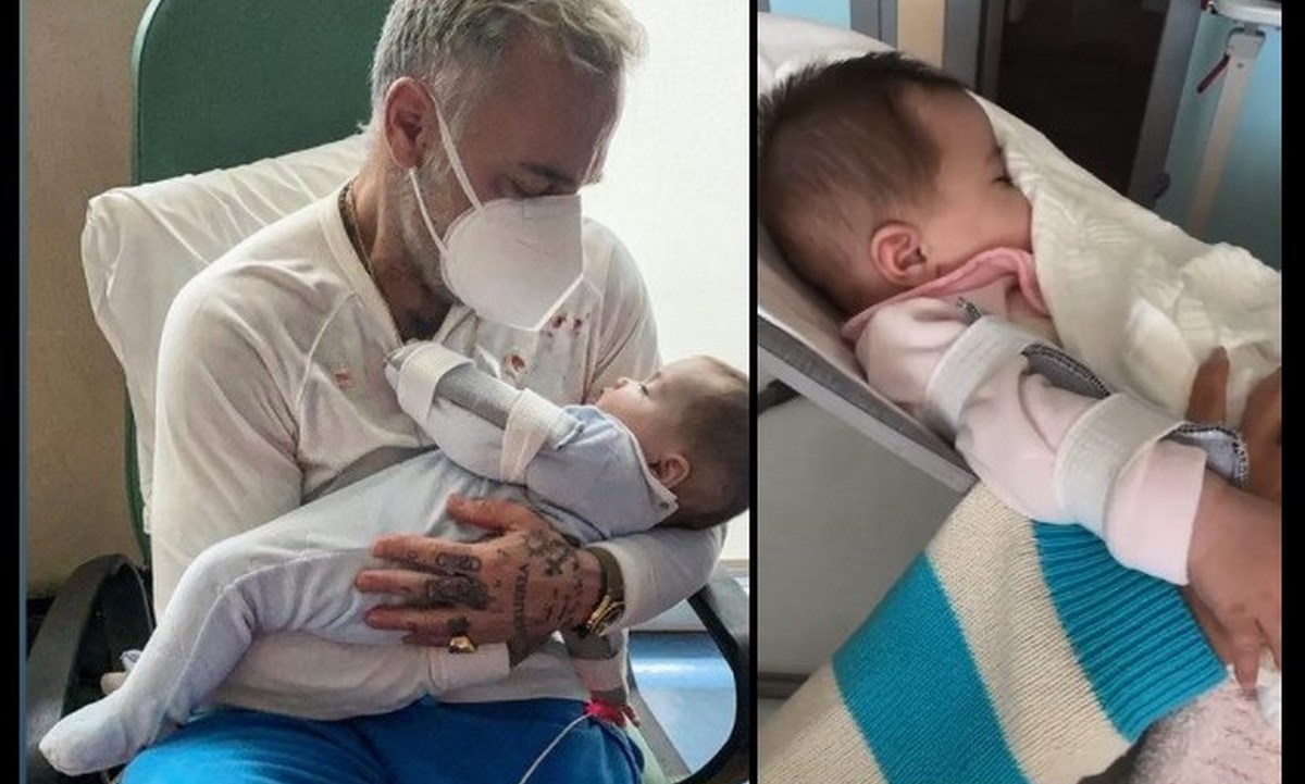 VIDEOS. Gianluca Vacchi tras cirugía de su hija por paladar hendido 1 gianluca paladar hendido