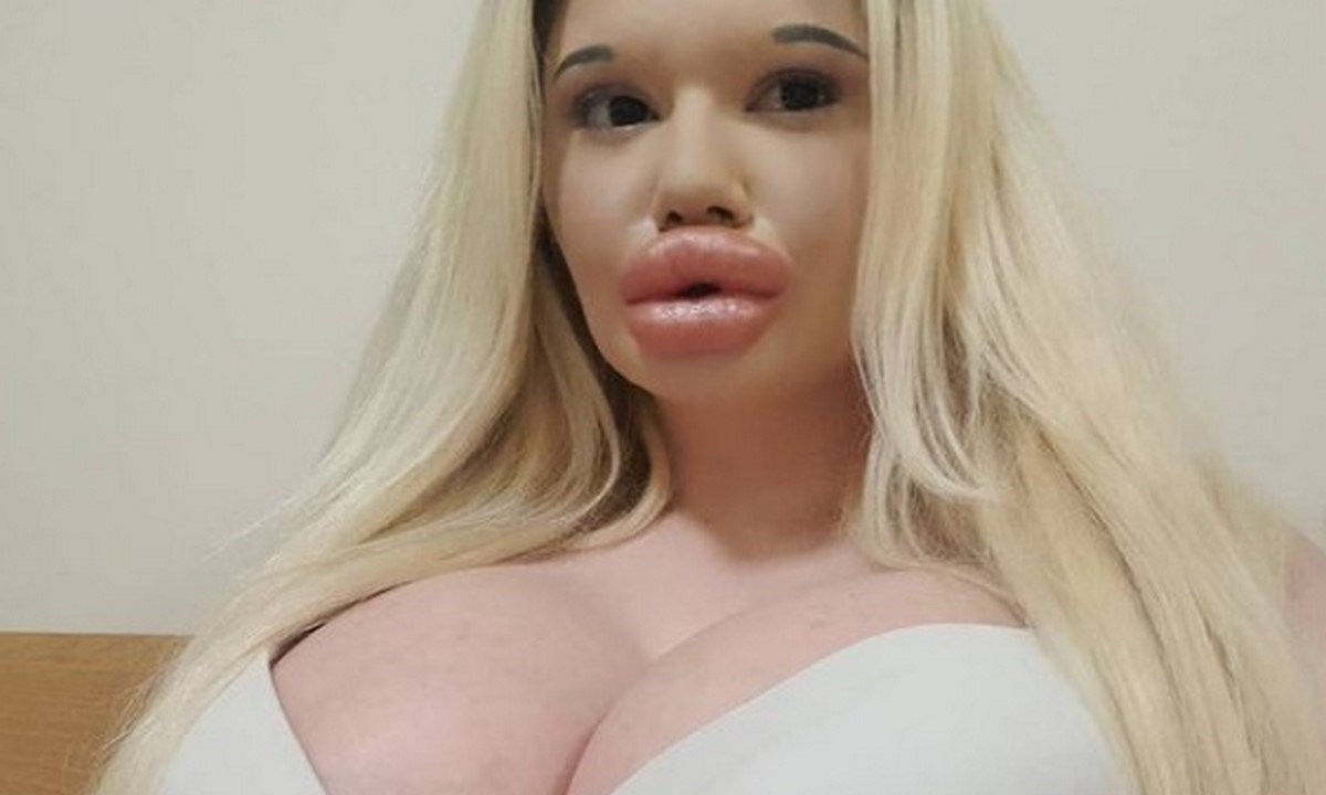 FOTOS. Así fue la transformación de la influencer con los labios más gruesos del mundo 5 influencer labiost 1