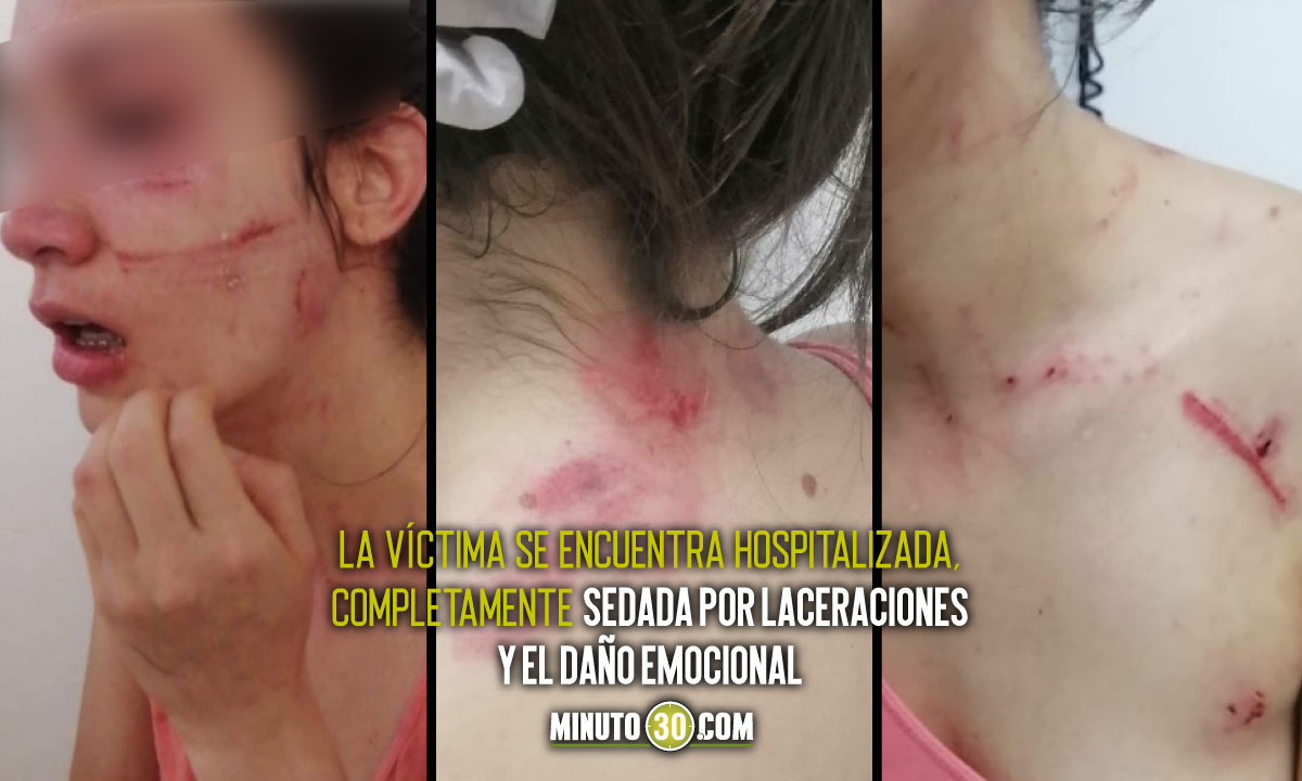 ¡Horrible! Sujeto entró a la casa de una mujer, la golpeó brutalmente para violarla y casi la mata 1 Circasia