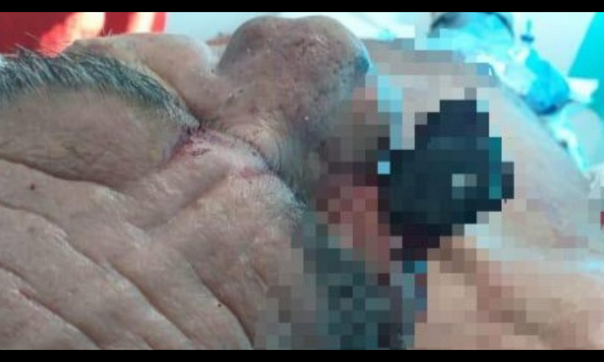 ¡Terrible! Un sujeto habría apuñalado en el rostro a su patrón 1 ¡Terrible! Un sujeto habría apuñalado en el rostro a su patrón