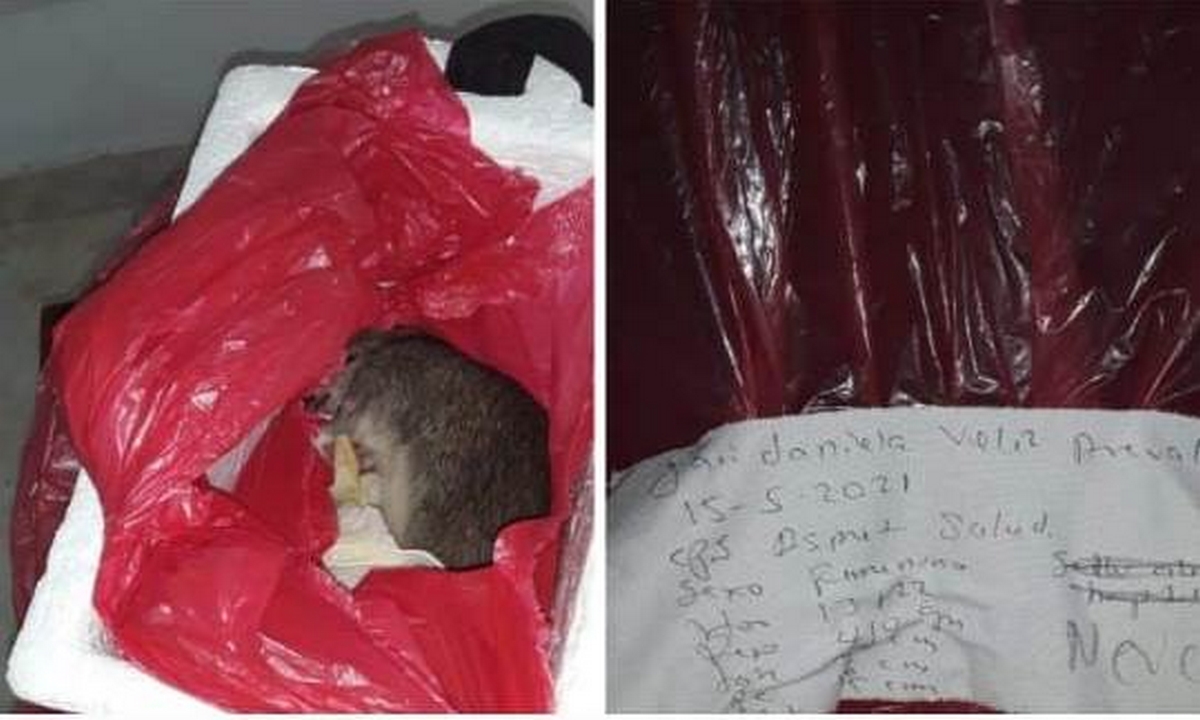 ¡Indignante!: En Tuluá una madre recibió una rata muerta en lugar del cuerpo de su bebé 1 Tuluá-madre-bebé-rata