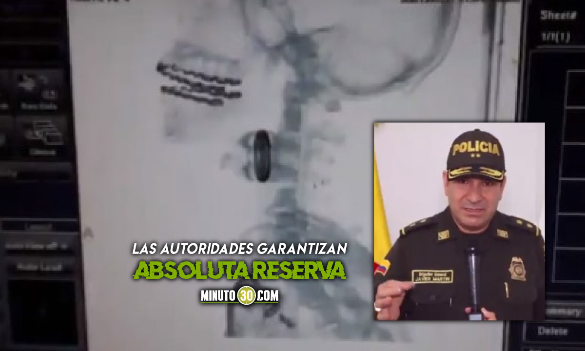 Hasta $20 millones de recompensa por responsables de ataque a policías en Bucaramanga 1 Hasta $20 millones de recompensa por responsables de ataque a policías en Bucaramanga