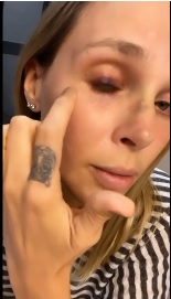 ¿Le pegaron? Elizabeth Loaiza mostró un moretón en el ojo tras, según dijo, golpearse en el baño 1 Elizabeth Loaiza
