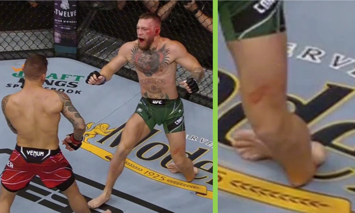 VIDEO: ¡En plena pelea! Momento en que se da la fractura del tobillo de McGregor 1 mcgregor