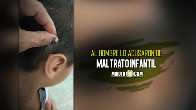 Hombre-le-pego-las-orejas-a-su-hijo-para-que-no-le-hicieran-bullying-en-el-colegio-por-orejon (1) Magangué