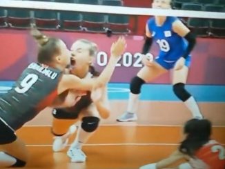 Doloroso golpe, jugadora de vóley se rompió varios dientes tras choque de cabezas 1 Voleibol jugadora tokio 2021