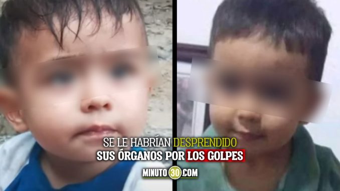 Bebé murió por los golpes que le habría dado su padrastro Bebé murió por los golpes que le habría dado su padrastro