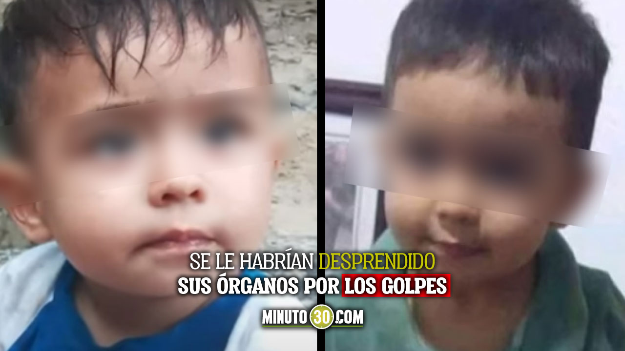 Bebé murió por los golpes que le habría dado su padrastro