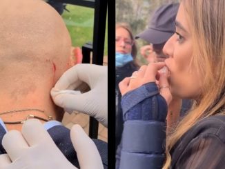 Dos actores de 'La Reina del Flow' sufrieron heridas reales en medio del rodaje 1 la reina del flow