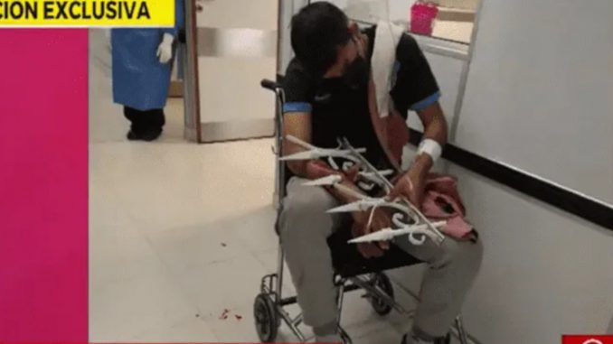 ladron se clavo una reja ladrón