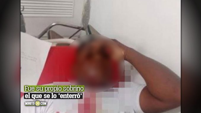 Hombre terminó con cucharón en su cara durante riña familiar Hombre terminó con cucharón en su cara durante riña familiar