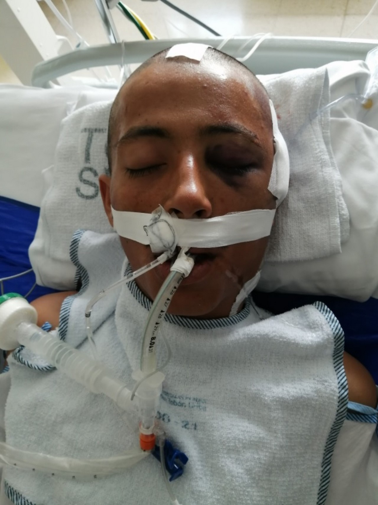 FOTO: ¡Buscan a su familia! Este paciente está en el Hospital Pablo Tobón Uribe de Medellín 1 NN 1