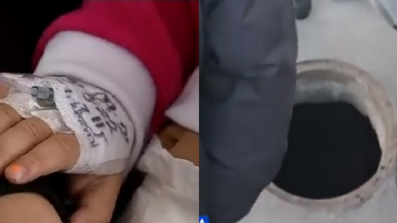 Niña y su padre cayeron a una alcantarilla a la que le robaron la tapa