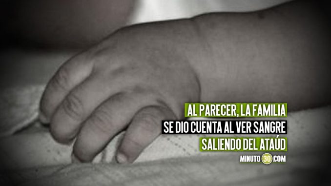 bebe Familia recibió una pierna amputada en vez de su bebé muerto