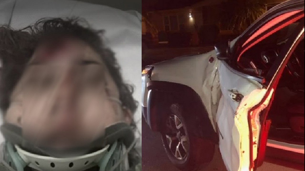 Colombiana atropellada en Miami por conductor que se voló