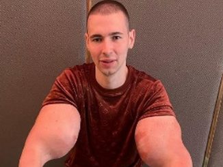 En medio de una pelea se le reventaron los brazos al “Popeye humano” 1 popeye humano Kirill Tereshin ruso