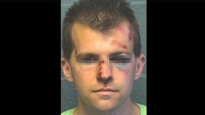 Golpeó fuertemente a un sacerdote cuando lo vio manoseando a su hijo Golpeó fuertemente a un sacerdote cuando lo vio manoseando a su hijo