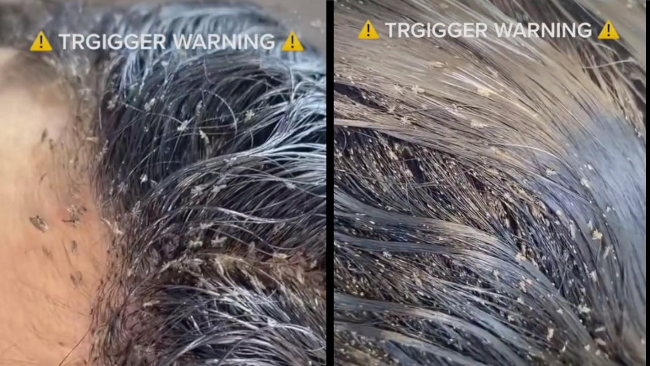 [Video] ¡Espantoso! Repleta de piojos llegó una niña a una peluquería para que la ayudaran