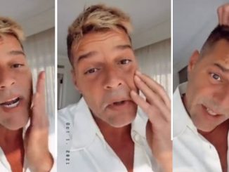 Ricky Martin contó el procedimiento que se hizo en su rostro 1 Ricky Martin procedimiento rostro