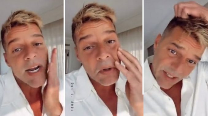 Ricky Martin procedimiento rostro