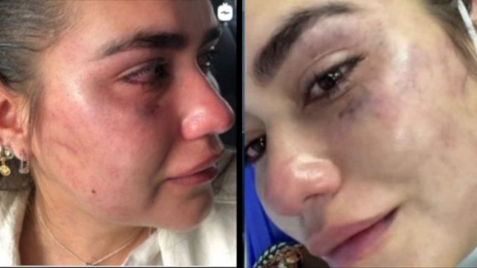 disenadora golpiza ex