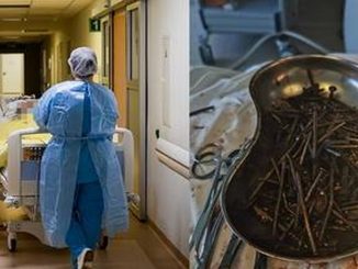 ¡Increíble! Médicos extrajeron más de un kilo de clavos y tornillos del estómago de un hombre 1 hombre