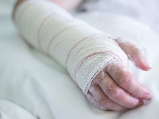¡Inaceptable! Hombre le prendió fuego a su pareja porque no lavó los platos 1 hombre