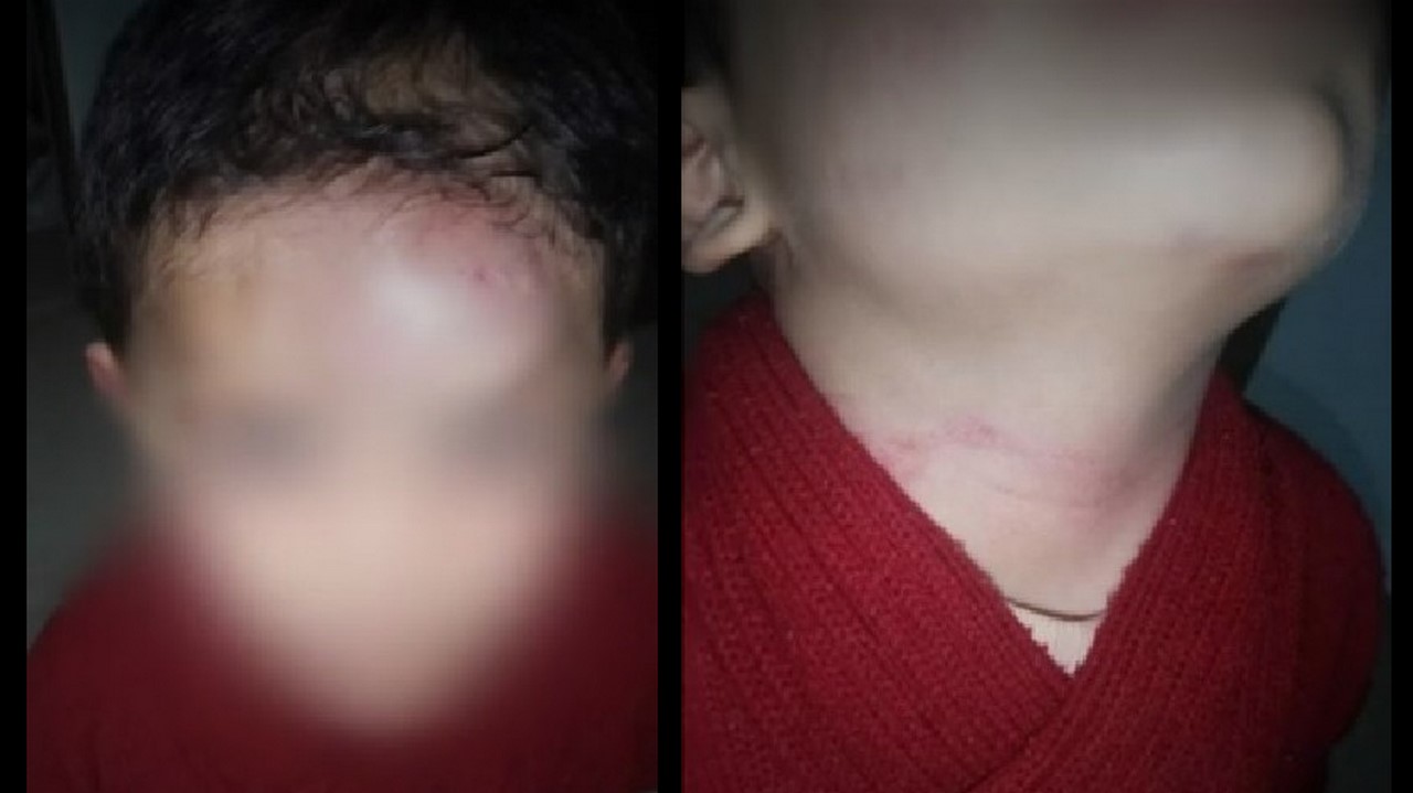Denuncian que niño habría sido golpeado por su padrastro