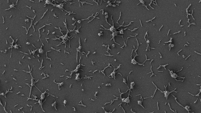 Imagen cedida de células de Mycoplasma pneumoniae, pequeñas bacterias que están naturalmente adaptados al pulmón humano. Créditos: Maria Lluch / CRG. píldora viva