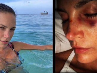 Juliana Galvis generó un debate en redes sociales con una foto donde aparece golpeada 1 Juliana Galvis foto aparece golpeada 2021