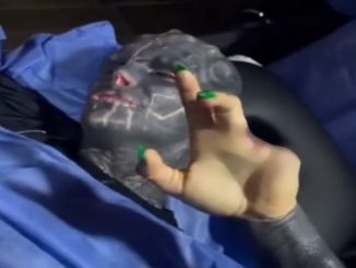 VIDEO: ¡Qué impresión! Hombre se quitó dos dedos de la mano para parecerse a un alien 1 hombre