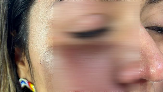 Mujer habría sido golpeada durante partido en Cali Mujer habría sido golpeada durante partido en Cali