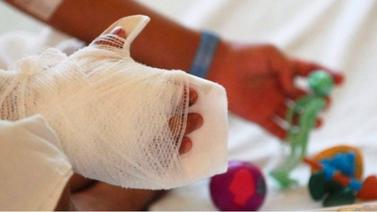 Lesionados con pólvora en Medellín superó el acumulado de 2022