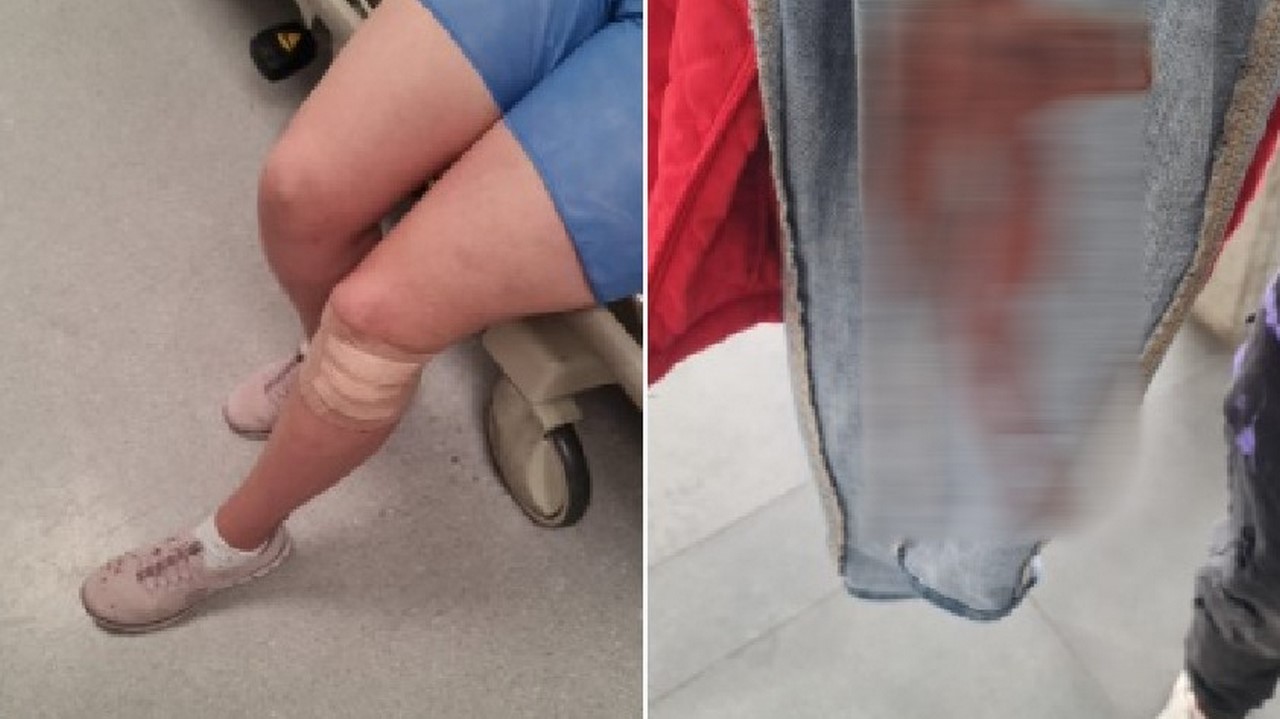 Apuñalaron a la esposa de un concejal en el TransMilenio