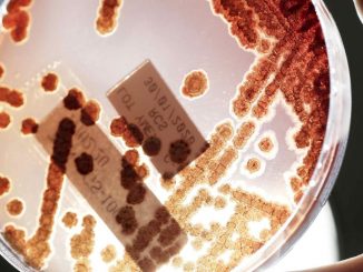 ¡Póngale cuidado! Resistencia a antibióticos produce más muertes que el SIDA y la malaria 1 resitencia antibioticos