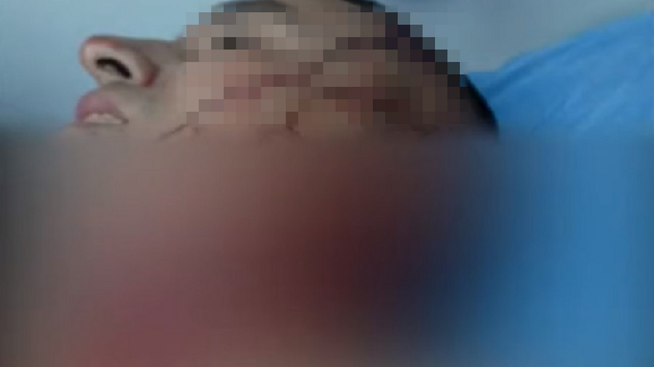 Perros atacaron a conductor de camión en Cundinamarca