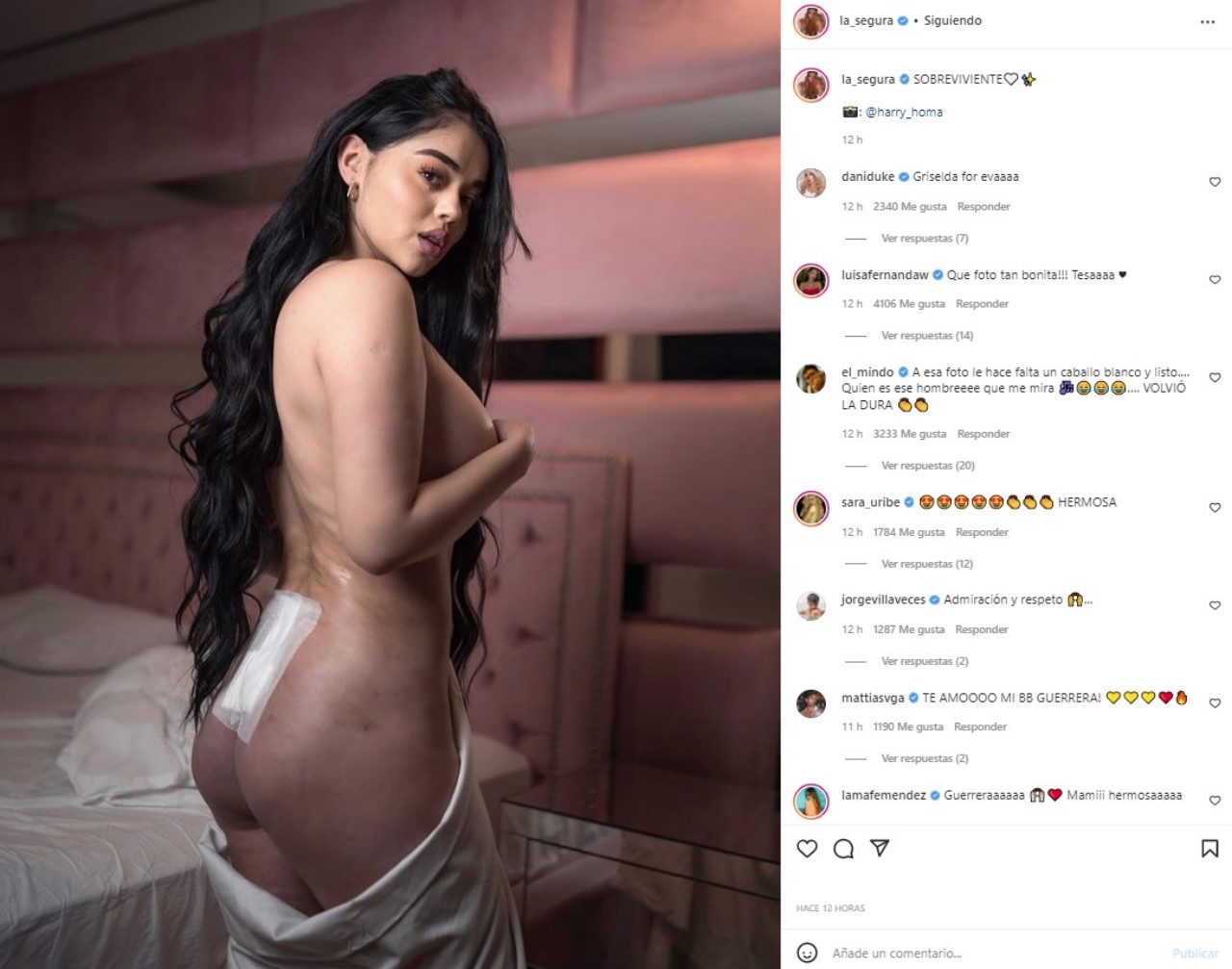 FOTO. La Segura se desnudó para mostrar cómo le quedó su cuerpo tras los  biopolímeros | Minuto30