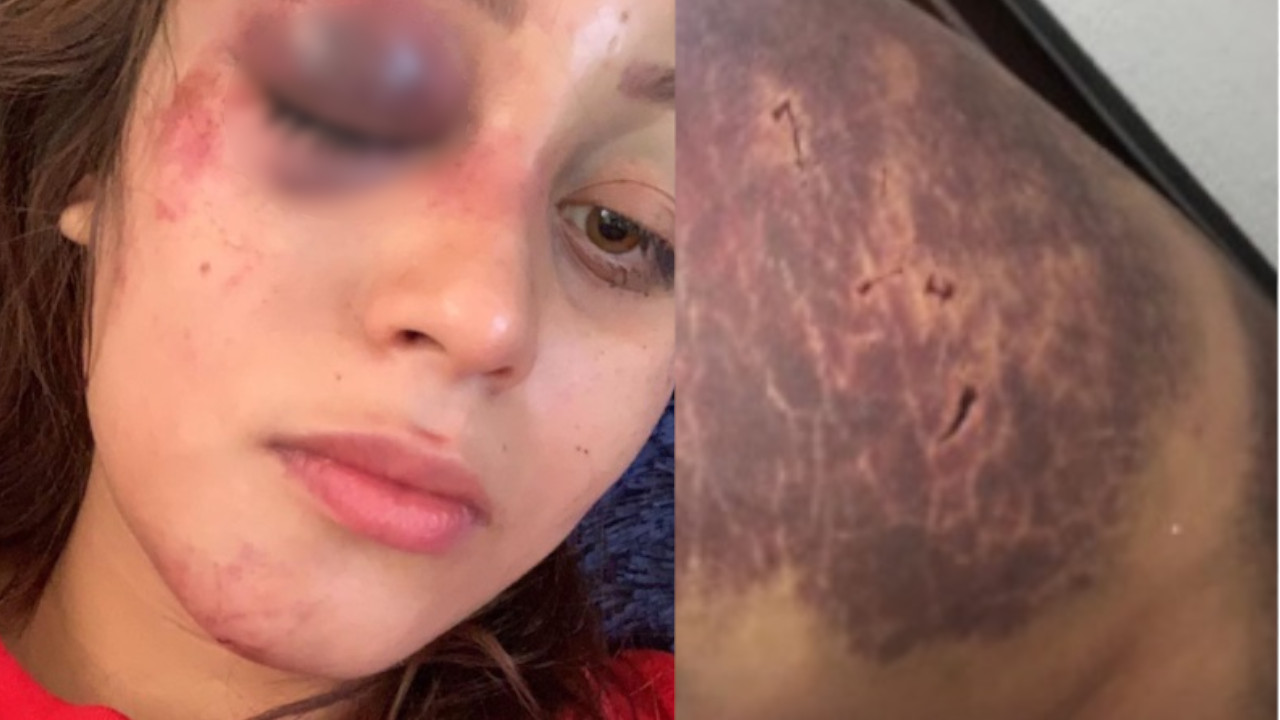 Joven mexicana asegura haber sido brutalmente maltratada por su exnovio