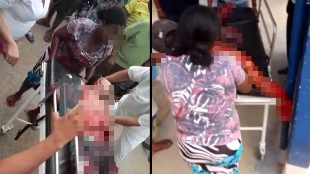 [Video] Por pedirle a un hombre que no orinara delante de una niña, le cortaron las manos a un joven