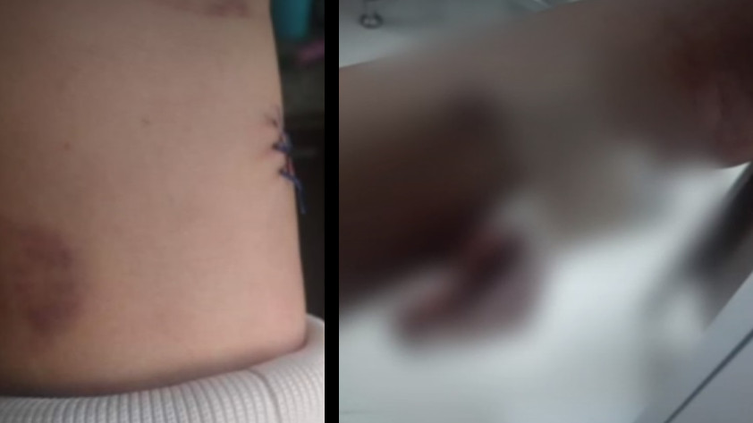 Denuncian que niño de 11 años fue apuñalado con una navaja en colegio de Bogotá