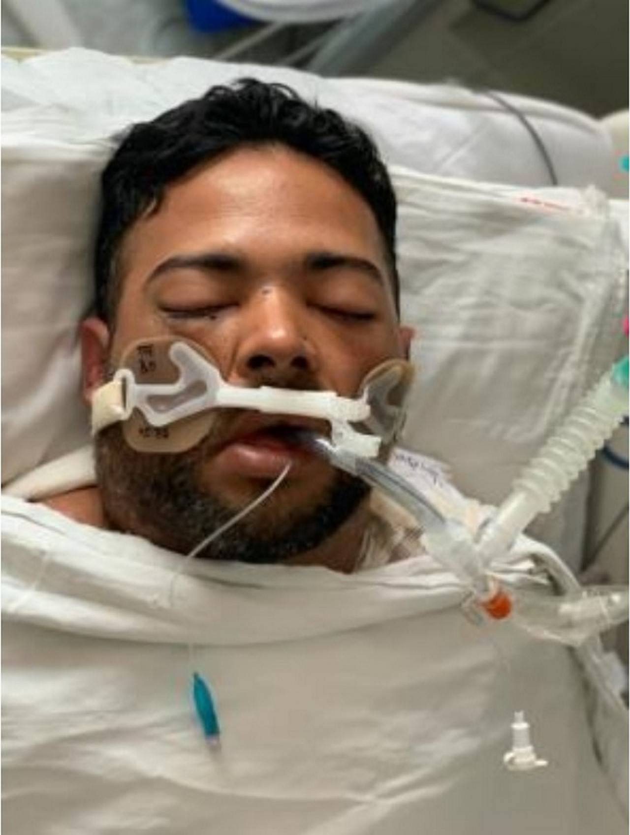 FOTO: Buscan a familiares de paciente venezolano que está en el Hospital General de Medellín 2 venezolano 1