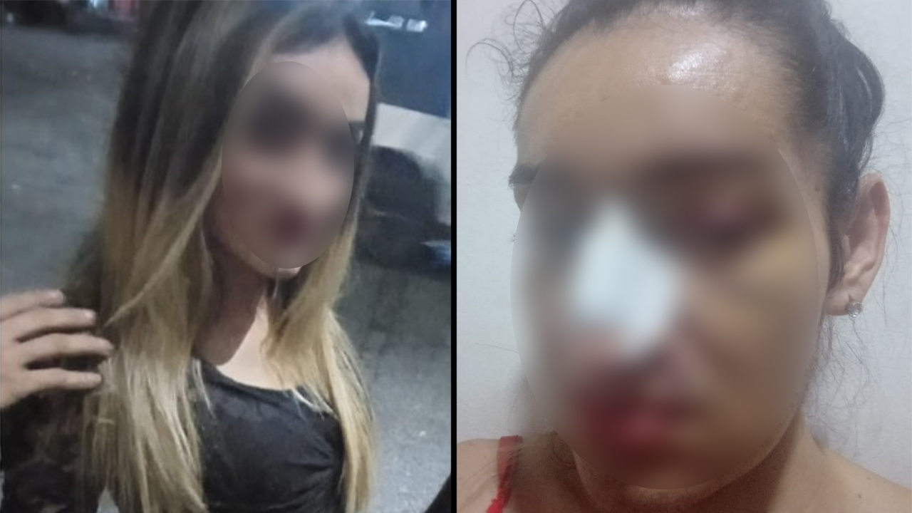 Mujer trans fue atacada con una navaja en un hotel de Medellín
