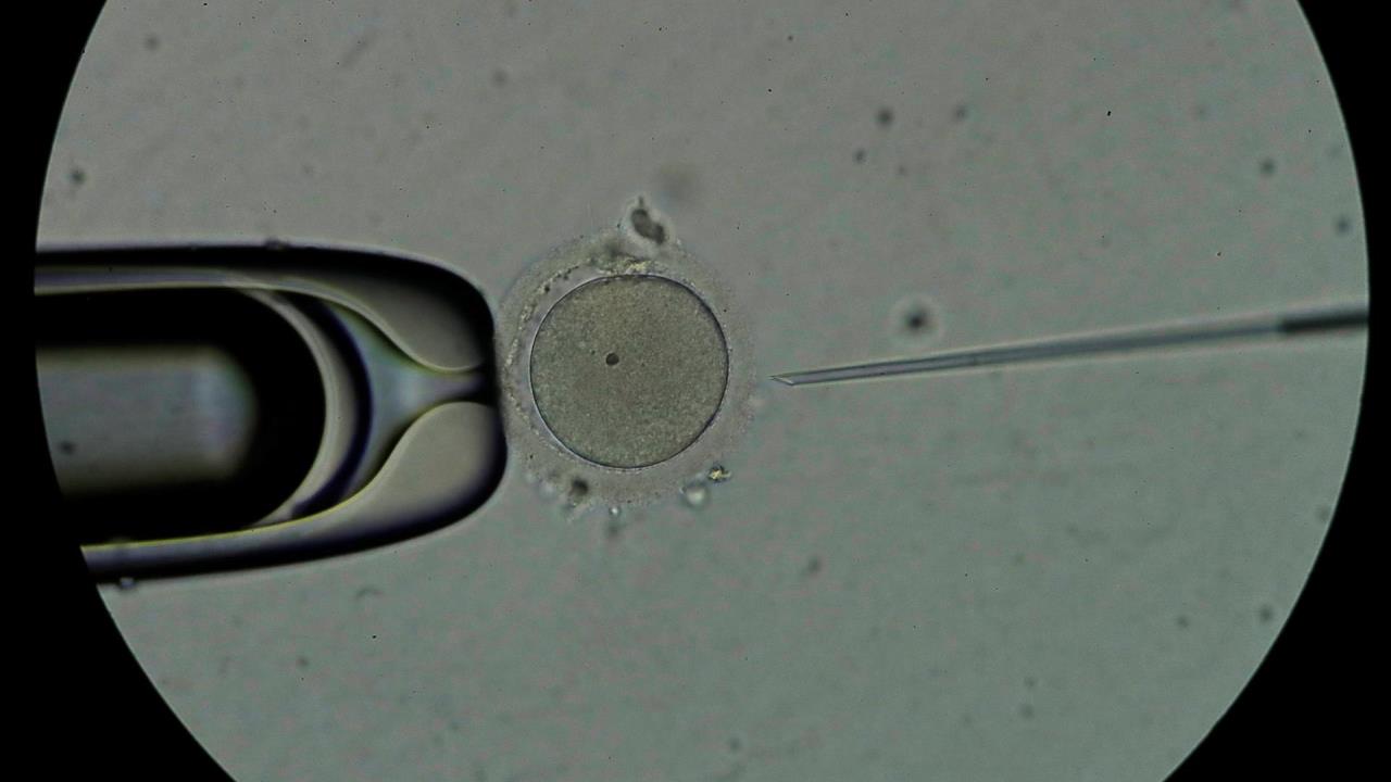 Confirman que en reproducción asistida también nacen más niños que niñas