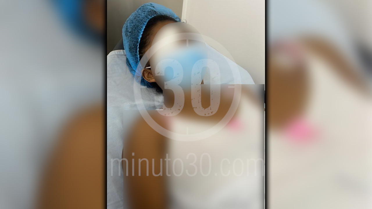 A una niña le dispararon en su carita, al parecer, habría sido un compañero del colegio