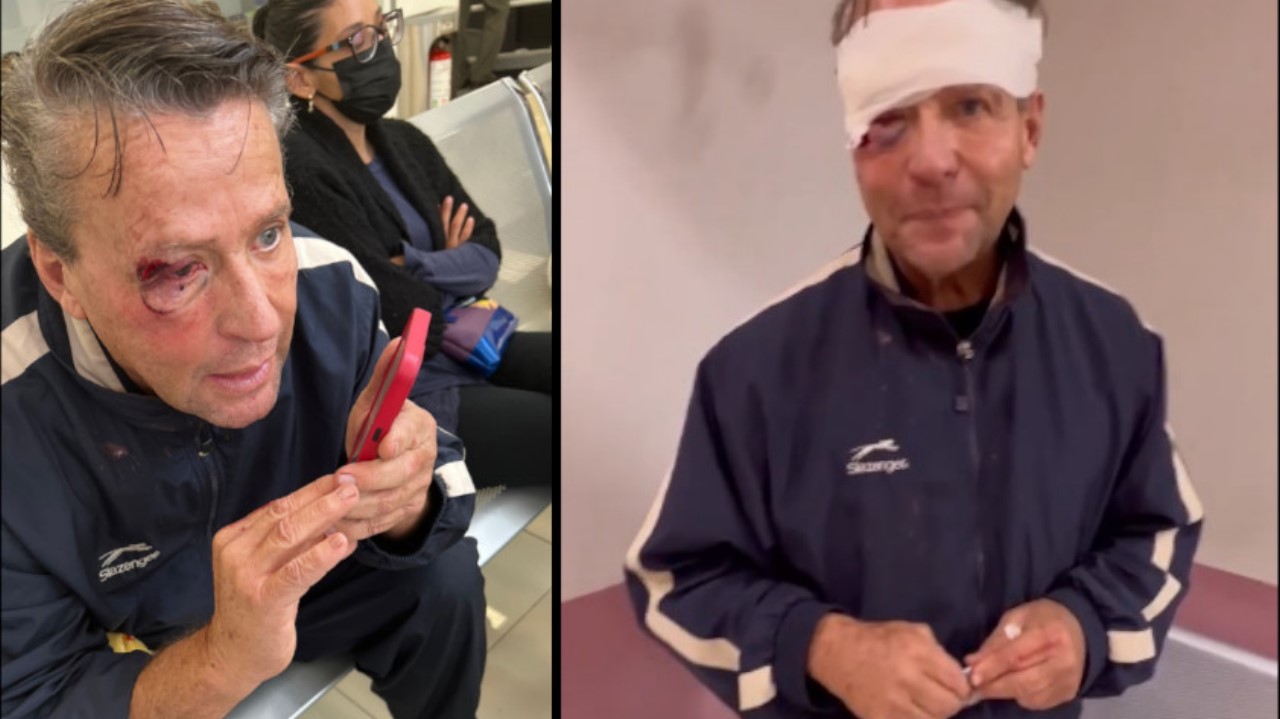 VIDEO. Reconocido actor sufre golpiza al frente de su casa