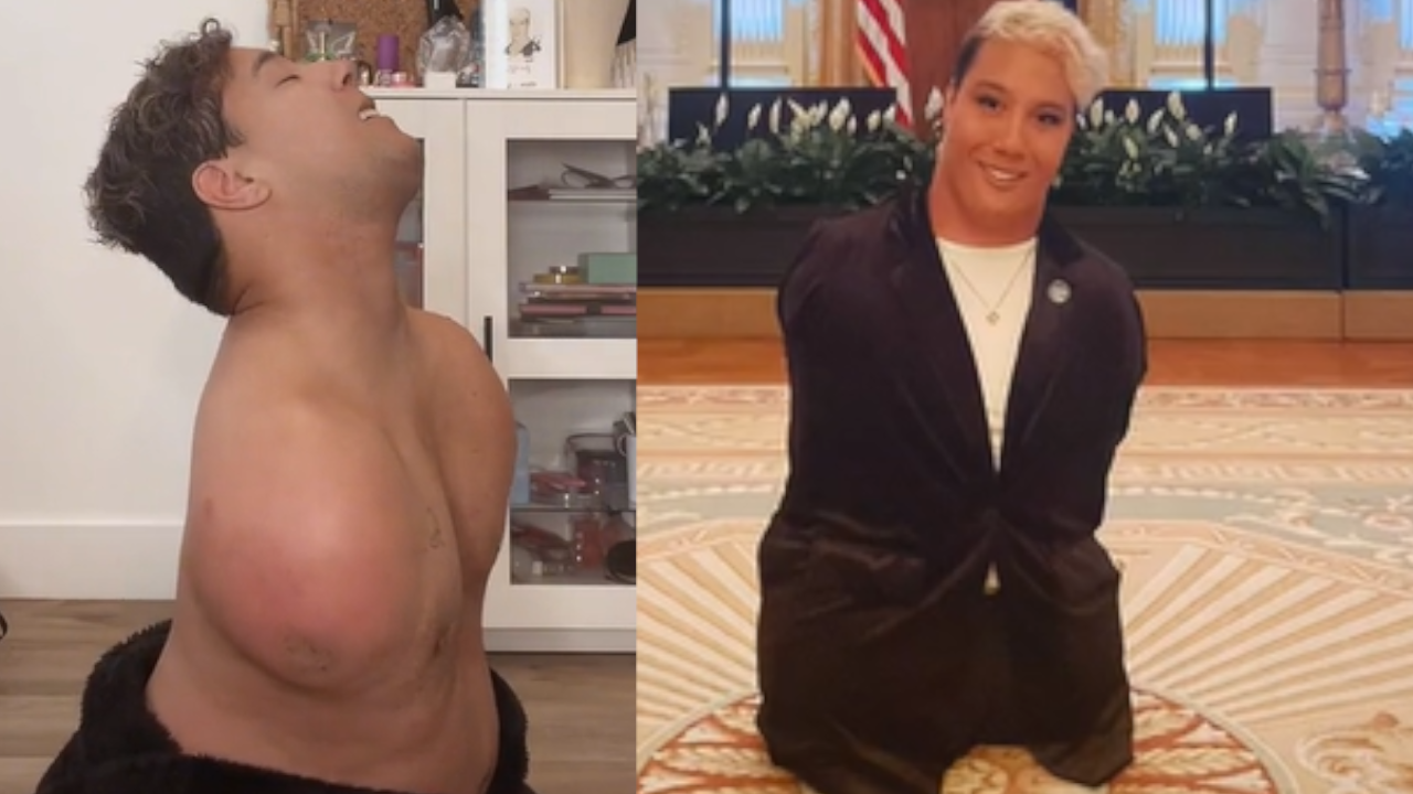 Lo abandonaron por nacer sin brazos y piernas y ahora es un influencer admirado y exitoso