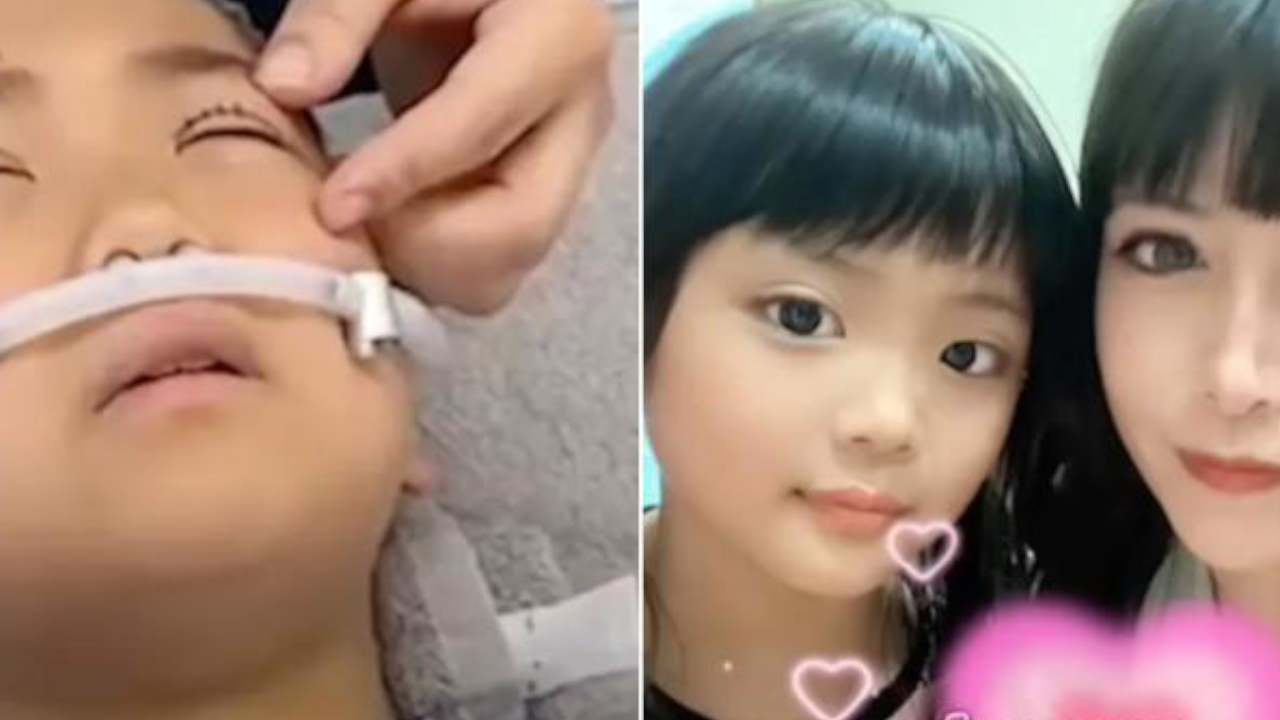 Mujer causa polémica en redes por realizarle cirugía estética a su hija de 9 años 