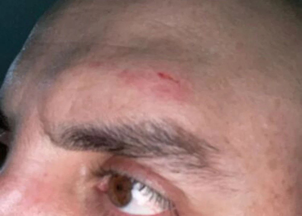 Hombres armados golpearon al gerente del hospital de Campamento, Antioquia