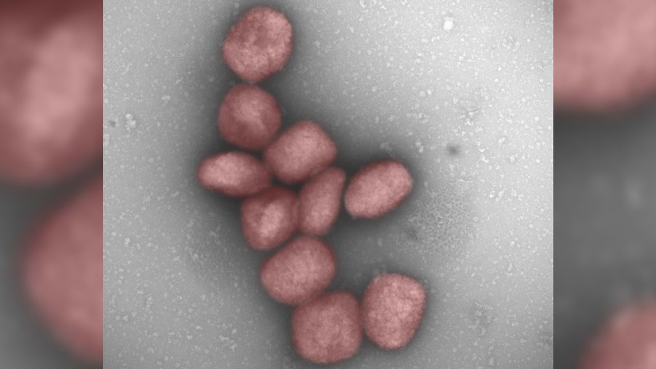 ¡OJO! El virus de la viruela del mono podría transmitirse también por vía aérea